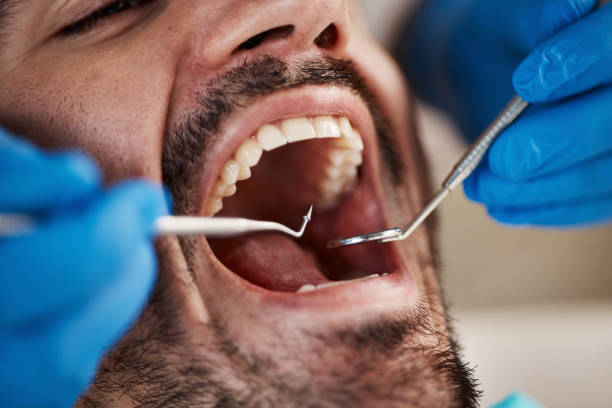 Best Urgent Tooth Repair  in Rohnert Park, CA